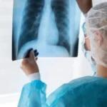 Алматы в авангарде: город успешно выполнил все задачи по борьбе с туберкулезом