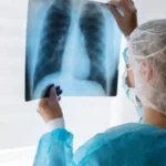 Казахстан: заметные успехи в борьбе с туберкулезом и укреплении здоровья нации